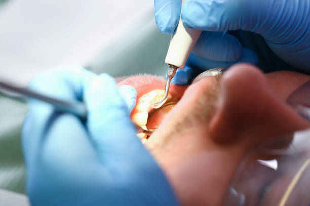 Best Emergency Broken Tooth Repair in Perham, MN